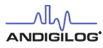 Andigilog